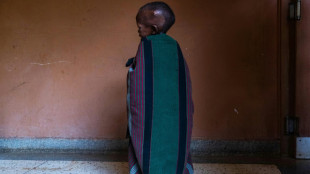 Hunger claims children in forgotten corner of Uganda