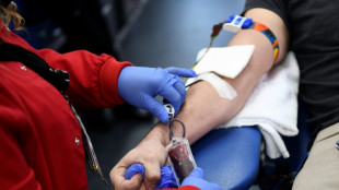 US set to ease AIDS-era blood donation rules for gay men